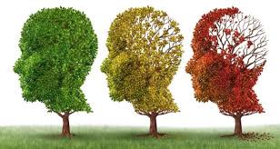 Alzheimer’s Disease - Advance Physio Waterford